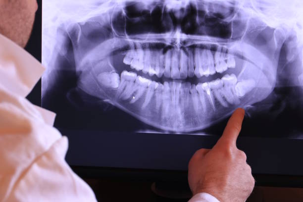 Best Emergency Dentist for Knocked-Out Tooth in Worthington, OH